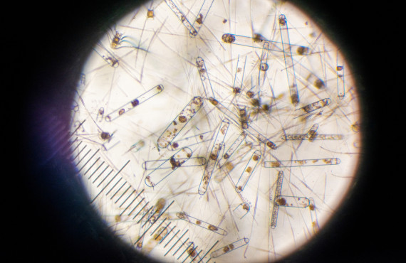 tan2101 01 29 compound microscope bongo DSC2439